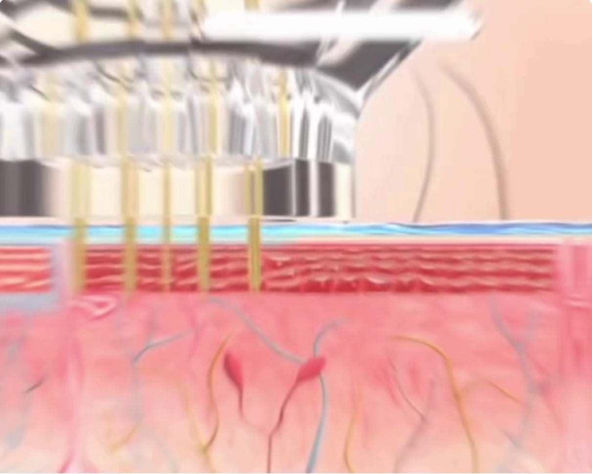 Charger la vidéo : 